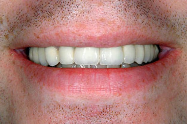 Smile Gallery, Smile Gallery, Sunninghill Dental